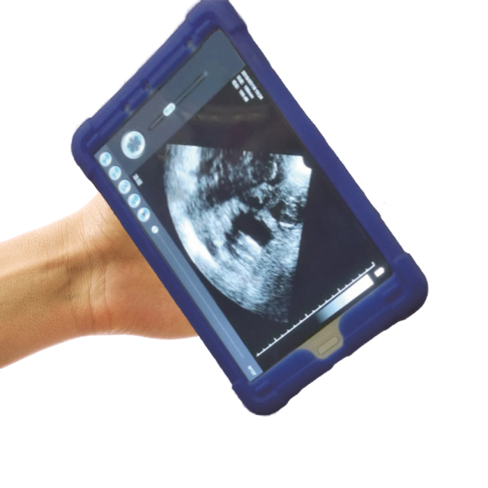 Беспроводной УЗИ сканер «Acrosoma S3 Plus»