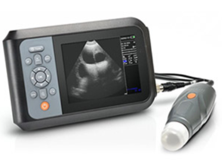 Сканер ультразвуковой с абдоминальным зондом